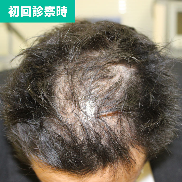 初回診察時