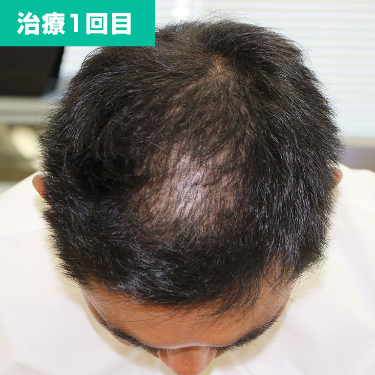 1回目