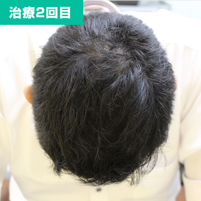 2回目