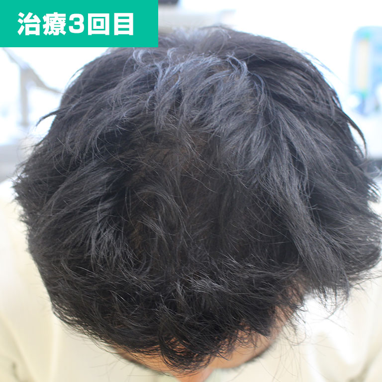 3回目