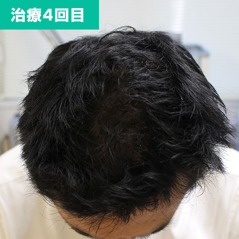 4回目