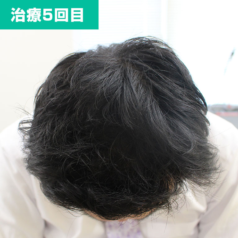 5回目