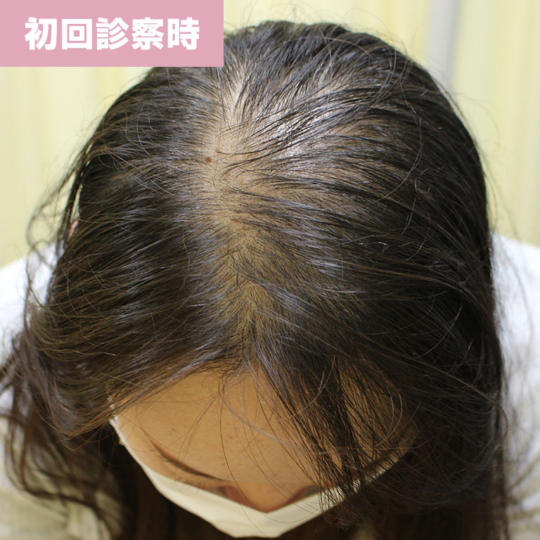 初回診察時