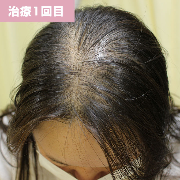 1回目