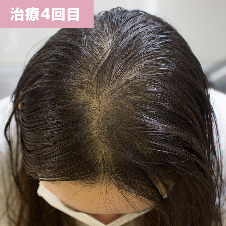 4回目